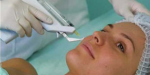 Permanent Hair Removal